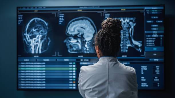 neuromielitis-descifrando-los-misterios-de-una-enfermedad-autoinmune imagen de artículo
