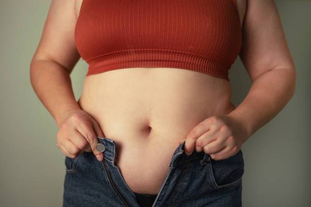 gastroplastia-endoscopica-una-nueva-opcion-para-combatir-la-obesidad imagen de artículo