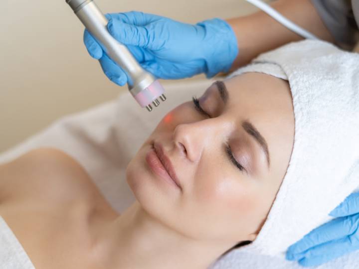 laser-co-fraccionado-vanguardia-antienvejecimiento-rejuvenecimiento-facial imagen de artículo