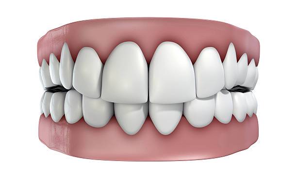 implantes-dentales-alternativas-avanzadas-para-la-rehabilitacion-oral imagen de artículo