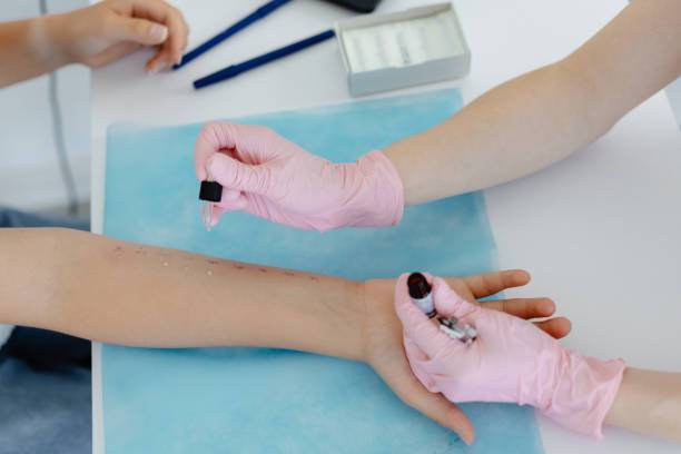 pruebas-de-alergia-plan-de-accion-para-un-tratamiento-adecuado imagen de artículo