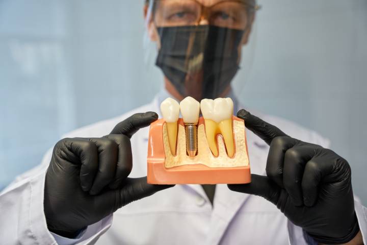 que-es-la-implantologia-dental-y-como-ha-evolucionado-con-la-odontologia-digital imagen de artículo