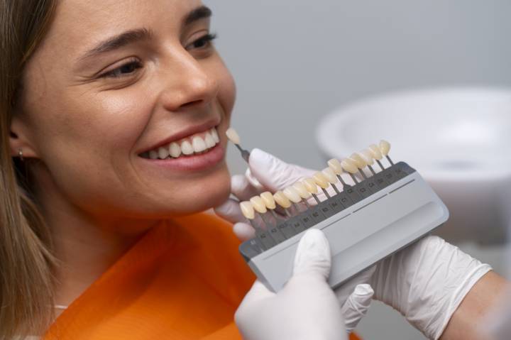 carillas-dentales-procedimiento-materiales-y-resultados-esperados imagen de artículo