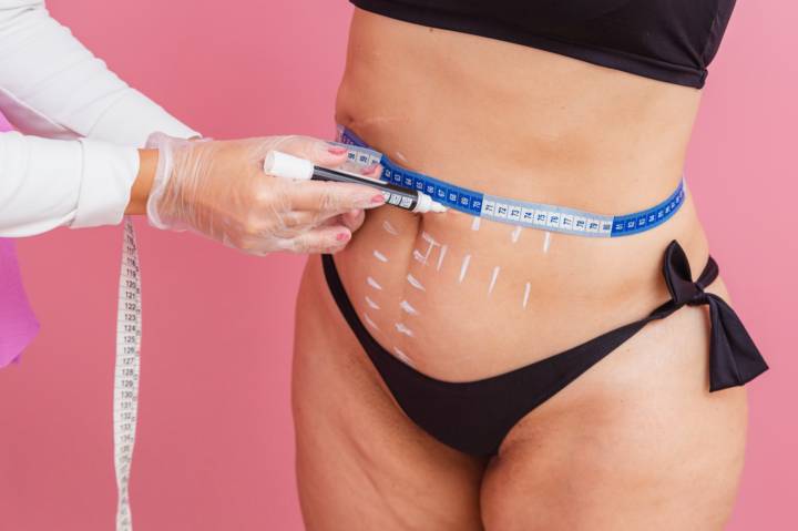 mommy-makeover-cirugia-estetica-postparto-recuperar-silueta imagen de artículo