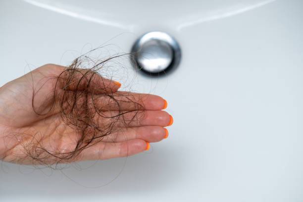 el-impacto-positivo-del-manejo-de-la-alopecia-con-exosomas imagen de artículo