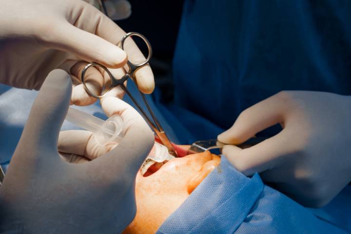 cirugia-mucogingival-que-es-indicaciones-tecnicas-mas-utilizadas imagen de artículo