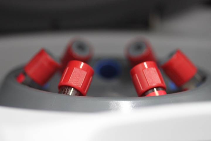 plasma-rico-fibrina-para-mejorar-cicatrizacion-postquirurgica imagen de artículo