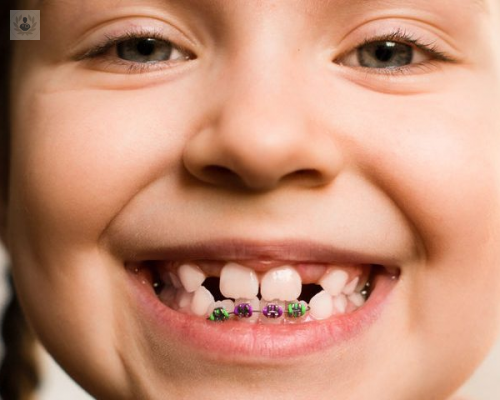 ortodoncia-infantil-un-diagnostico-precoz-ayuda-al-tratamiento imagen de artículo