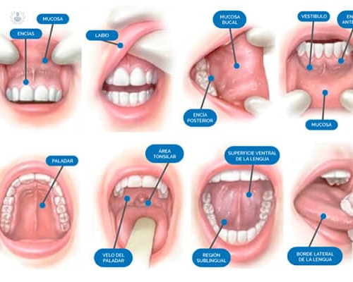 Medicina Oral, qué es y quién necesita sus tratamientos 