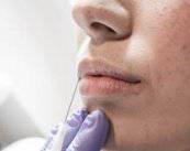 lipotransferencia-un-futuro-lleno-de-posibilidades imagen de artículo