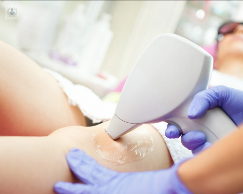 Laser Hair Removal: latest technology, myths and clarifications
