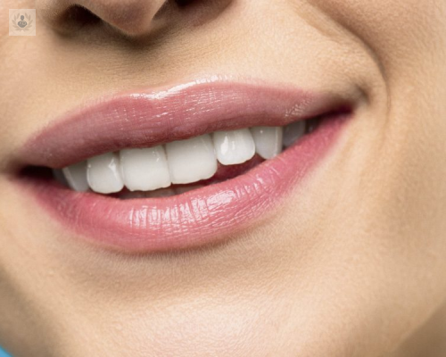 tecnicas-para-corregir-la-posicion-de-los-dientes imagen de artículo