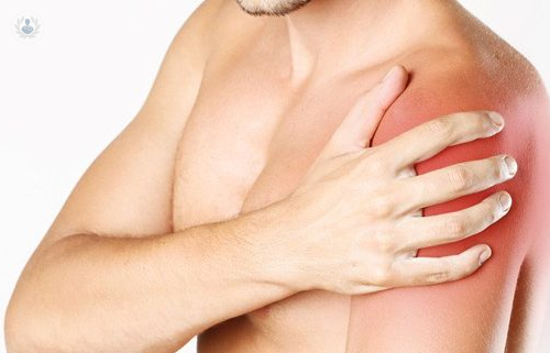 Capsulitis Adhesiva de Hombro