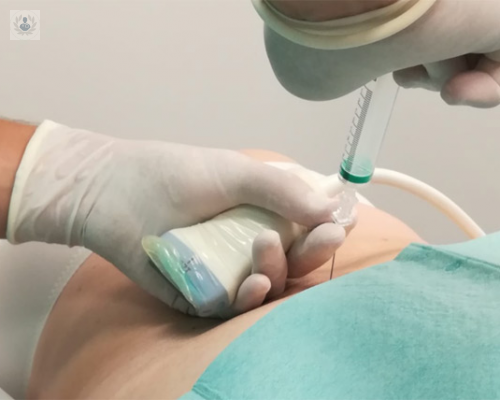 ozonoterapia-en-la-fibromialgia imagen de artículo