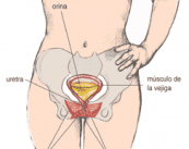 Diagnóstico y tratamiento de la Incontinencia Urinaria