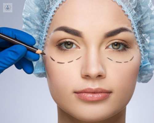 blefaroplastia-que-es-sus-resultados-y-la-recuperacion imagen de artículo