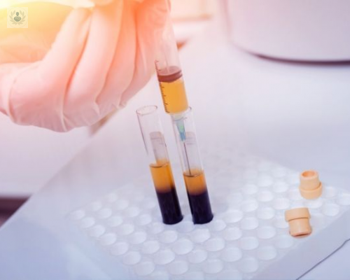 lesiones-para-tratar-con-factores-de-crecimiento imagen de artículo