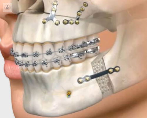 ortodoncia-y-cirugia-ortognatica imagen de artículo