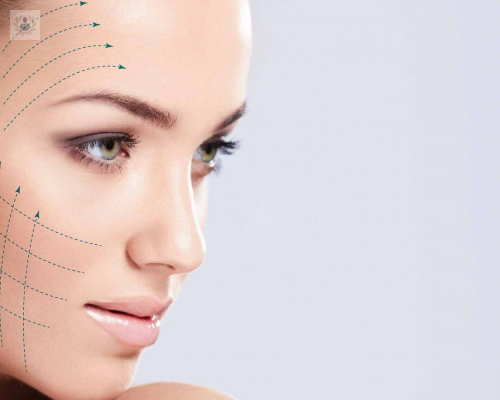 lifting-sin-cirugia imagen de artículo