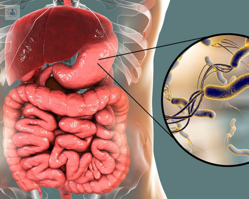 Helicobacter Pylori: Causas, síntomas y tratamiento | Top Doctors