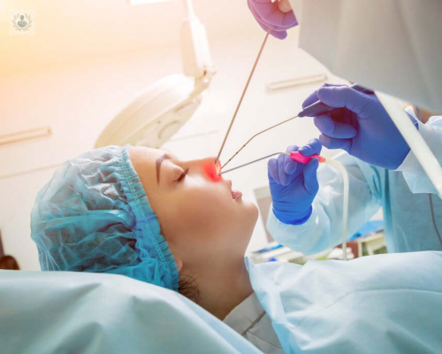 cirugia-endoscopica-nasal imagen de artículo