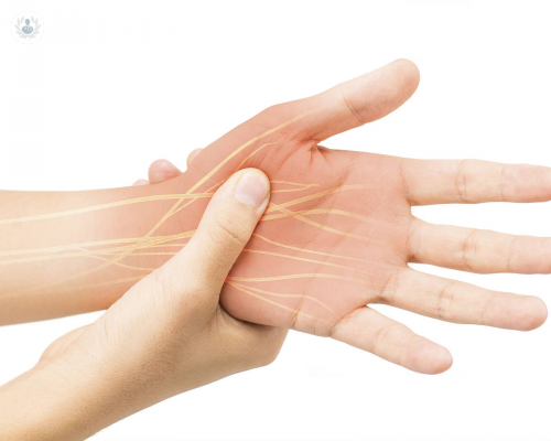 sindrome-del-tunel-carpiano imagen de artículo