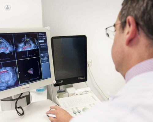 biopsia-de-prostata-con-histoscanning imagen de artículo