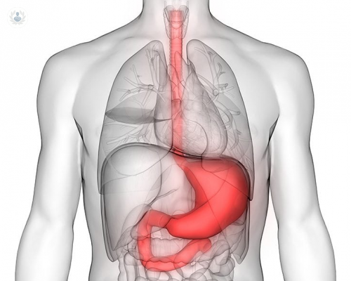 aneurisma-de-aorta imagen de artículo