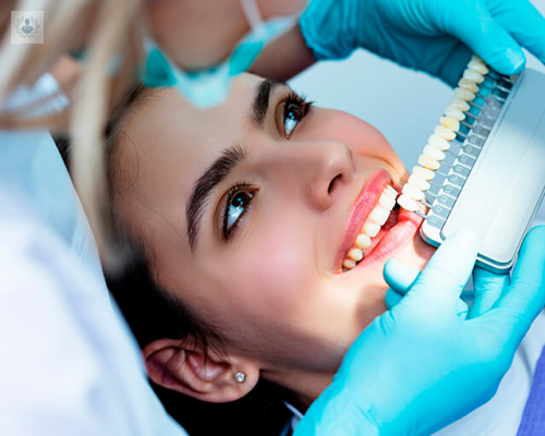 Blanqueamiento Dental: quiero, pero… ¿puedo?