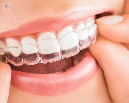 invisalign-la-ortodoncia-mas-estetica imagen de artículo