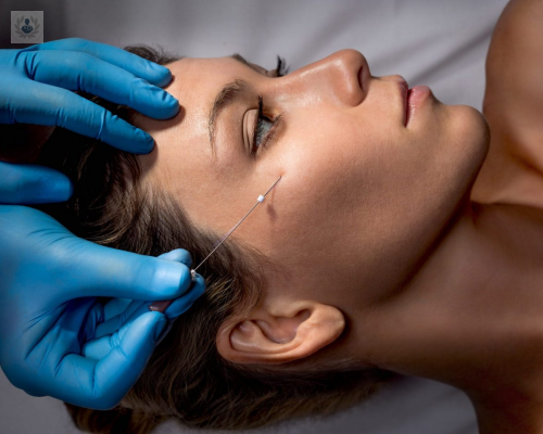 hilos-tensores-la-solucion-para-la-flacidez-en-los-brazos imagen de artículo