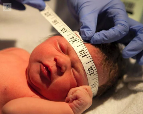 craneosinostosis-causas-y-tratamiento imagen de artículo