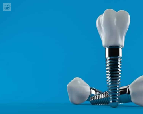 nuevas-tecnicas-en-implantes-dentales imagen de artículo