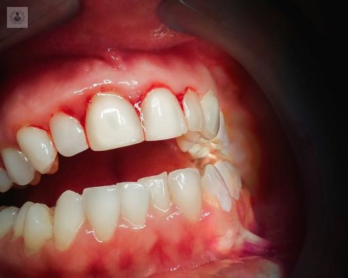 la-periodoncia-prevencion-de-las-enfermedades-de-las-encias imagen de artículo