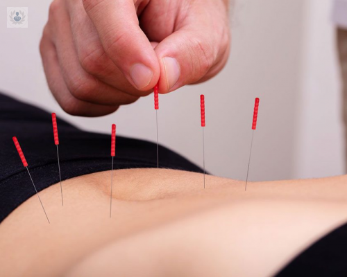 la-acupuntura-para-dejar-de-fumar imagen de artículo