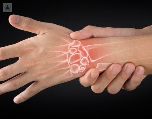 artritis-reumatoide-una-enfermedad-que-no-tiene-cura-pero-puede-detenerse imagen de artículo