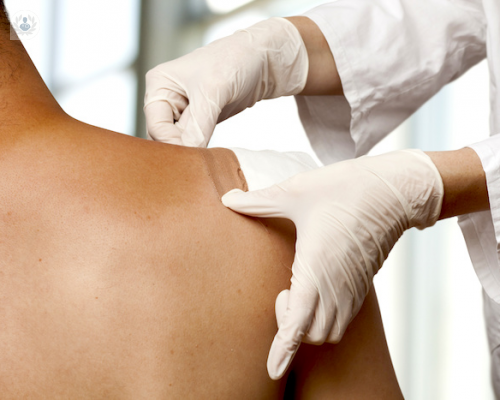 la-microcirugia-de-mohs-procedimiento-y-post-operatorio imagen de artículo