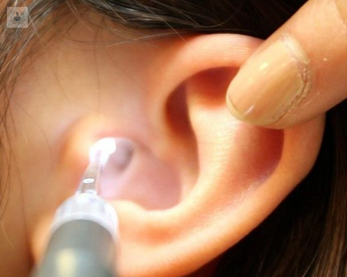 Tapón de cera en los oídos: ¿cómo quitarlos? - Instituto ORL IOM Madrid