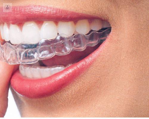 Invisalign, la solución a los dientes de conejo