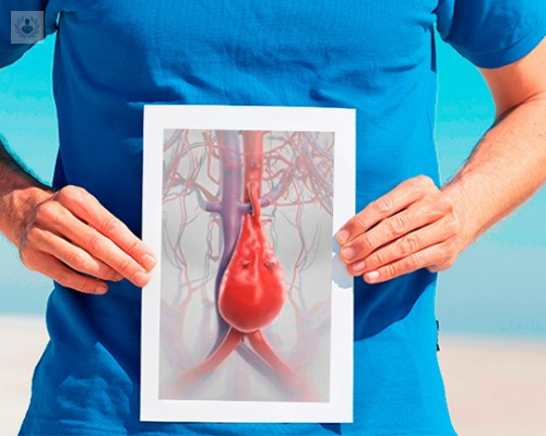 causas-y-tratamiento-del-aneurisma-de-aorta imagen de artículo