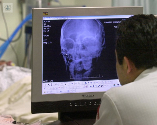 el-dano-cerebral-una-enfermedad-con-multiples-victimas imagen de artículo