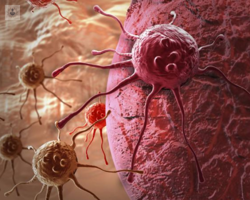 tumores-de-origen-desconocido imagen de artículo