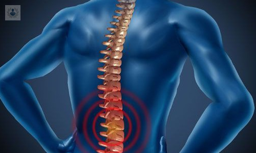 guia-de-la-neuroestimulacion-medular imagen de artículo