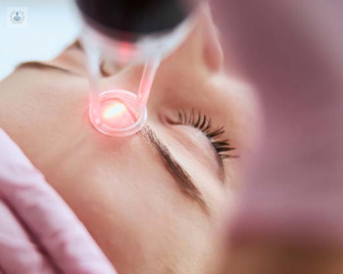 el-uso-de-laser-para-la-eliminacion-de-patologias-cutaneas imágen de artículo
