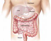 la-cirugia-colorrectal-que-tipos-existen-y-consejos-a-seguir-durante-el-postoperatorio imagen de artículo