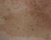 las-manchas-en-la-piel imagen de artículo