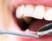 Prótesis Dentales: ¿Cuáles escoger? 
