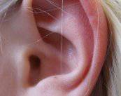 Cirugía del Oído Medio: ¿En qué consiste?