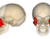 Los Implantes Cigomáticos 