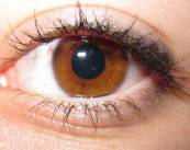 Diferentes tipos de Tumores Oculares y sus causas y síntomas